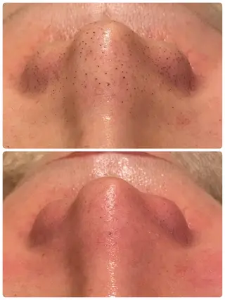 【リベルハーブピーリング認定店】敏感肌・美白脱毛専門店Dione立川店所属・Dione 立川店のエステ・リラクイメージ