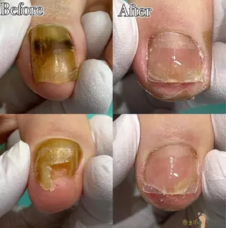 福岡巻き爪補正店 博多店のエステ・リラクイメージ