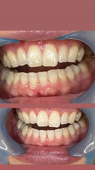 LAVISH nail salonのネイルデザイン