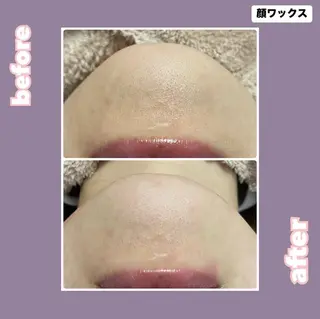 【痩身・脱毛サロン】 REBISKIN🌱のエステ・リラクイメージ