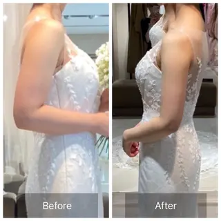 【元に戻らない】 小顔&部分痩せのその他イメージ