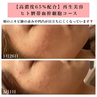 Bellesthe (ベルエステ)のエステ・リラクイメージ