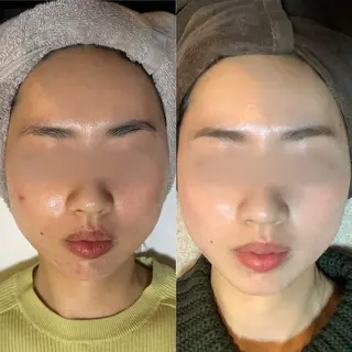 【BUB立川】 ななのエステ・リラクイメージ