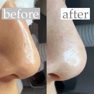 毛穴専門サロン ライカブルーのエステ・リラクイメージ