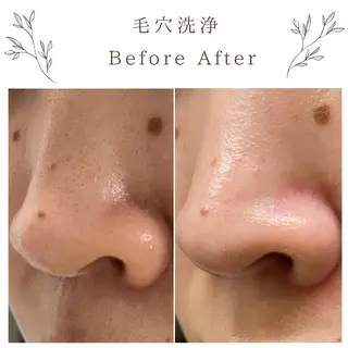 な ぎのエステ・リラクイメージ