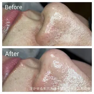 深い肌悩み専門 フェイシャルサロンのエステ・リラクイメージ