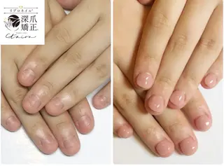 メンズ ネイル 深爪矯正専門店　ネイルサロン　トイロ所属・ネイルサロン トイロのネイルデザイン