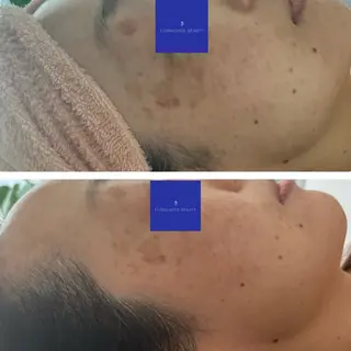 FLORALNOTE所属・ReCell 肌管理のエステ・リラクイメージ