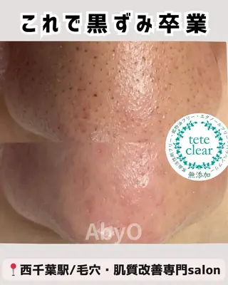 AxO Aestheticのエステ・リラクイメージ