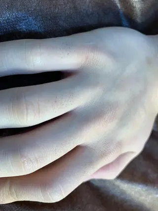 脱毛SALON RaYNiCKのエステ・リラクイメージ