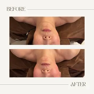 les SALON所属・大和郡山／慢性疲労 ／肩こり／むくみのエステ・リラクイメージ