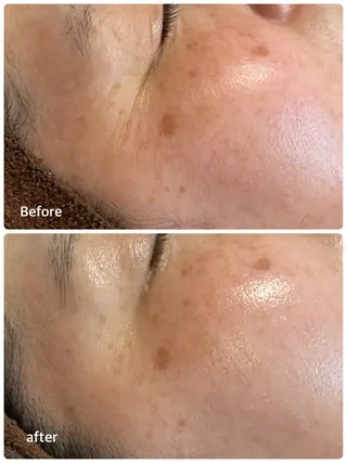 ビューティーサロン Claireのエステ・リラクイメージ