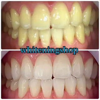 ホワイトニング ショップ吉祥寺店のエステ・リラクイメージ