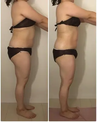 BELLEFINE 💕痩身・小顔・脱毛のエステ・リラクイメージ