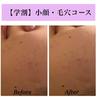 Bellesthe （ベルエステ）のエステ・リラクイメージ