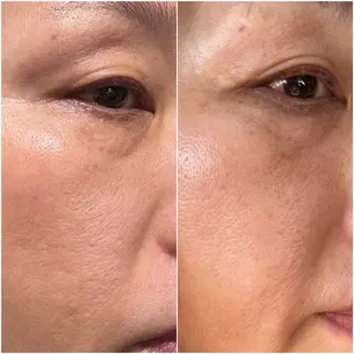 エステサロンMee. 大畑のエステ・リラクイメージ