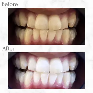 セルフホワイトニング エクシア天神店のその他イメージ