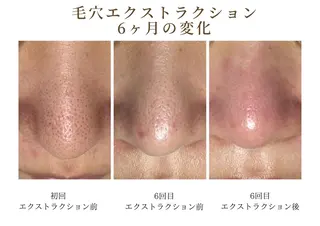 しおや ともこのエステ・リラクイメージ