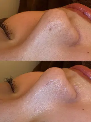 EARTH coiffure beaute 新潟紫竹山店所属・🤍アベシュリ /フェイシャル🤍のエステ・リラクイメージ