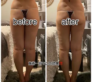 【痩身・脱毛サロン】 REBISKIN🌱のエステ・リラクイメージ