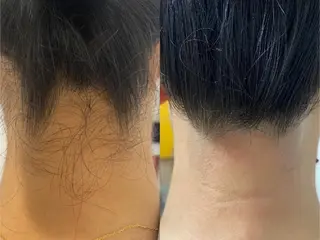 みんなの脱毛 TSURURINの眉毛・アイブロウイメージ