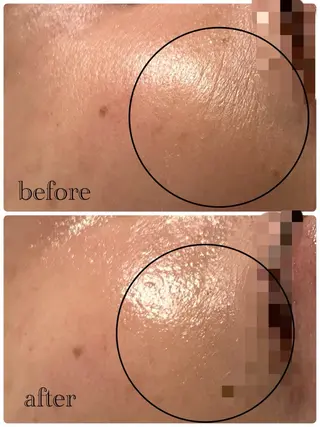 lumirise所属・lumi riseのエステ・リラクイメージ