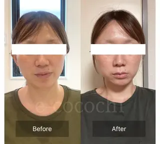 小顔と ヘッドスパのお店のエステ・リラクイメージ