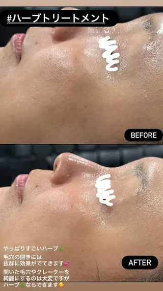 LiZA エステティックサロンのエステ・リラクイメージ