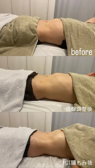 腸もみ・メンズ脱毛・ 毛穴洗浄〜カナロア〜のエステ・リラクイメージ