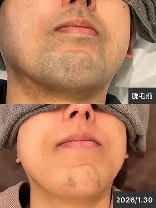 ELEGANCE所属・メンズ脱毛サロン BRIGHTのエステ・リラクイメージ