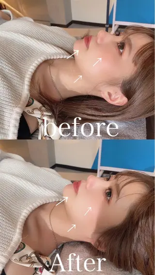 鍼灸整骨院Refine所属・鍼灸 Refineのその他イメージ