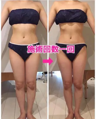 ロング カラー パーマ ヘアアレンジ メンズ キッズ ネイル マツエク・マツパ ‍痩身＆ボディ 結果出し🌟丹野のエステ・リラクイメージ