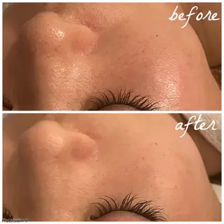 メンズ メナード岐阜市茜部 杉浦のエステ・リラクイメージ