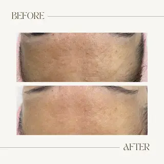 CEsalonEgg 齋藤のエステ・リラクイメージ