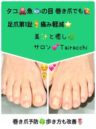 ネイル Tairacchi ﾀｲﾗｯﾁのエステ・リラクイメージ