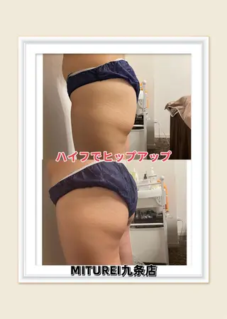 西区九条エステ MITUREIサロンのエステ・リラクイメージ