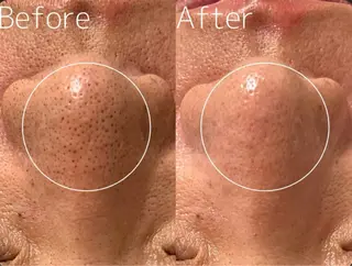 レイフィールド江南店所属・レイエステティック 江南店のエステ・リラクイメージ