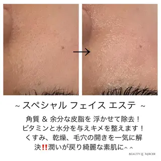 ビューティー ミロワールのエステ・リラクイメージ