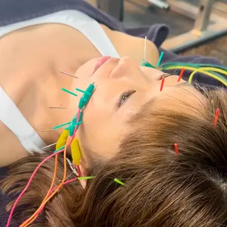 美容鍼・小顔矯正 FLOW 鍼灸整体院のその他イメージ