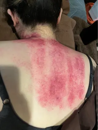 鍼灸院楽々館所属・宇田 碧のエステ・リラクイメージ