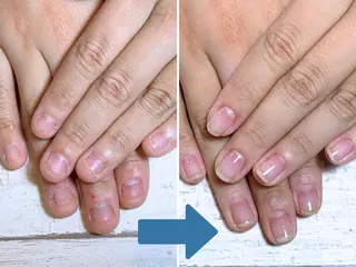 ネイル 深爪矯正・自爪育成 ネイルサロンアモまいのネイルデザイン