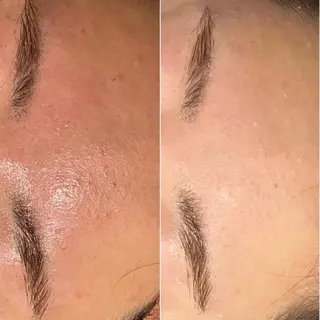 ニキビ・肌質改善専門 ♡人生が変わるサロンのエステ・リラクイメージ