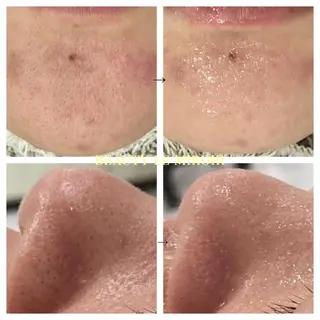 ビューティー ミロワールのエステ・リラクイメージ