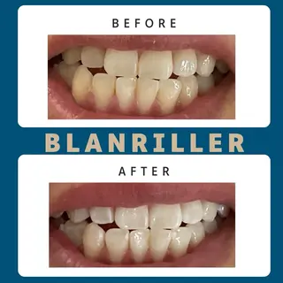 BLANRILLER所属・ホワイトニングサロン ブランリエ阿倍野店のその他イメージ