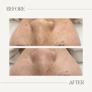 CEsalonEgg 齋藤のエステ・リラクイメージ