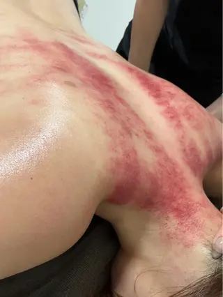 セルライトクラッシュ 腸もみ bi♡eruのエステ・リラクイメージ