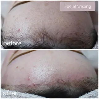 CLEAD 赤坂見附店のエステ・リラクイメージ