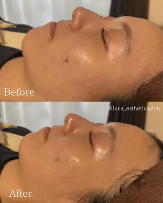 Luca所属・Luca ﾙｶのエステ・リラクイメージ