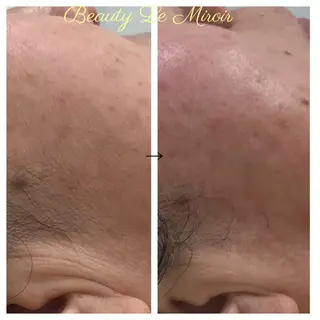 ビューティー ミロワールのエステ・リラクイメージ