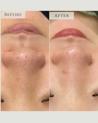 シミ毛穴|眉Wax THE  flowのエステ・リラクイメージ